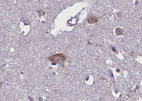 Phospho-TRKB (Tyr706) Antibody in Immunohistochemistry (Paraffin) (IHC (P))