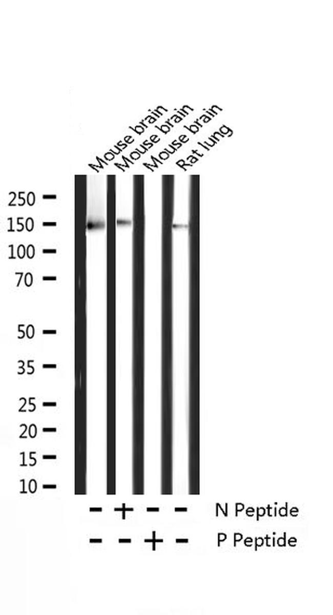 Phospho-TRKB (Tyr706) Antibody in Western Blot (WB)