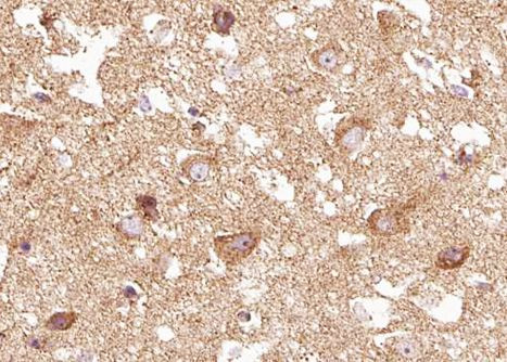 Phospho-TRKB (Tyr516) Antibody in Immunohistochemistry (Paraffin) (IHC (P))