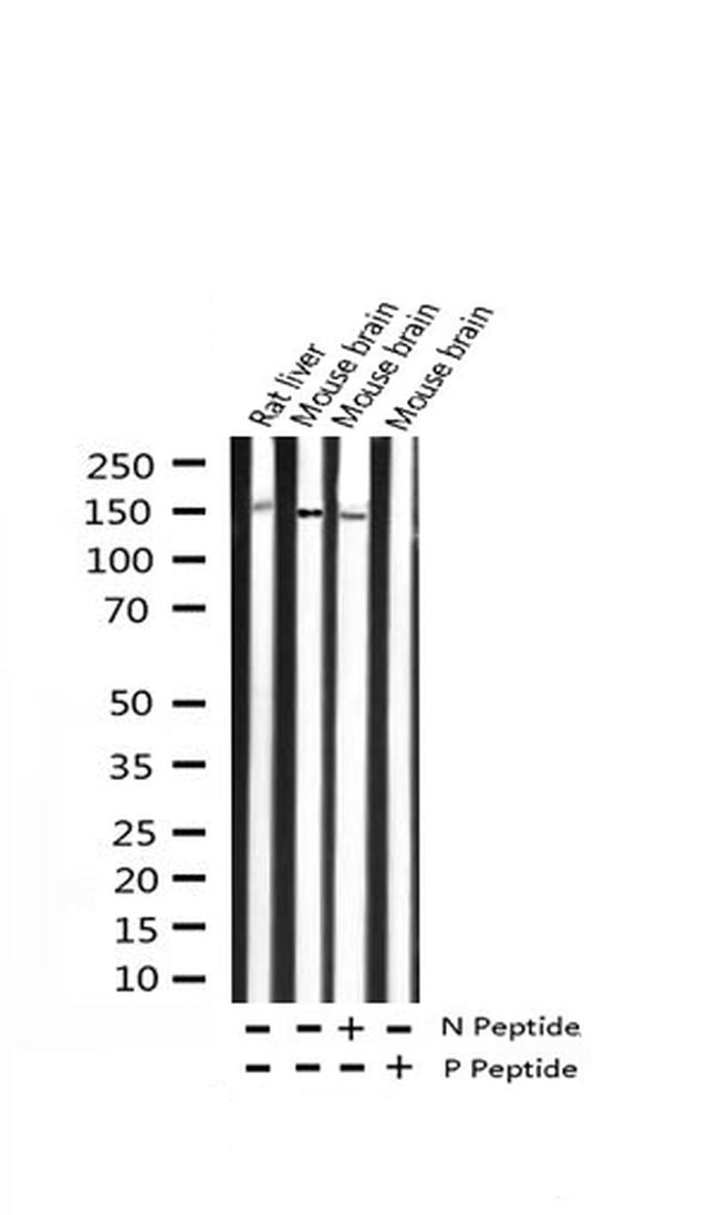 Phospho-TRKB (Tyr516) Antibody in Western Blot (WB)