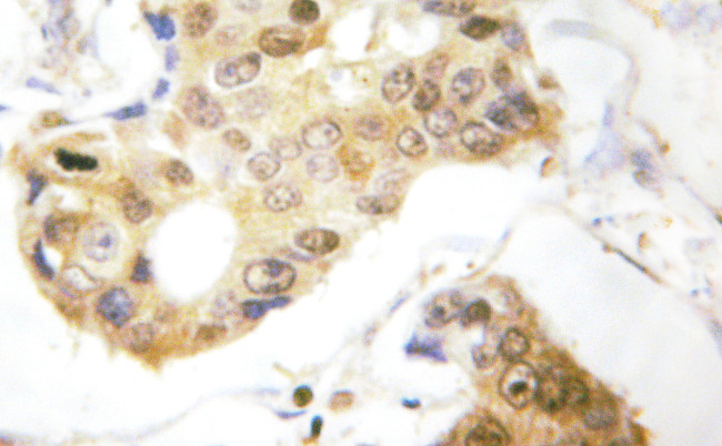 Phospho-PDCD4 (Ser457) Antibody in Immunohistochemistry (IHC)