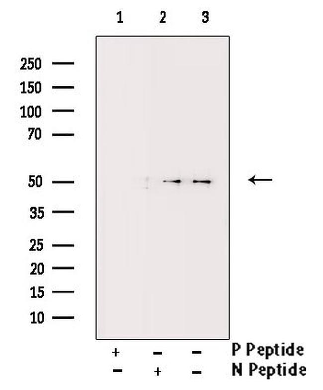 Phospho-PDCD4 (Ser457) Antibody in Western Blot (WB)