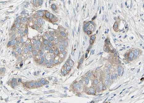 Phospho-BAD (Ser99) Antibody in Immunohistochemistry (Paraffin) (IHC (P))