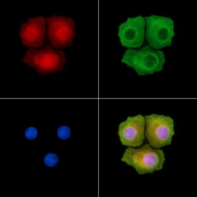 Phospho-FANCD2 (Ser222) Antibody in Immunocytochemistry (ICC/IF)