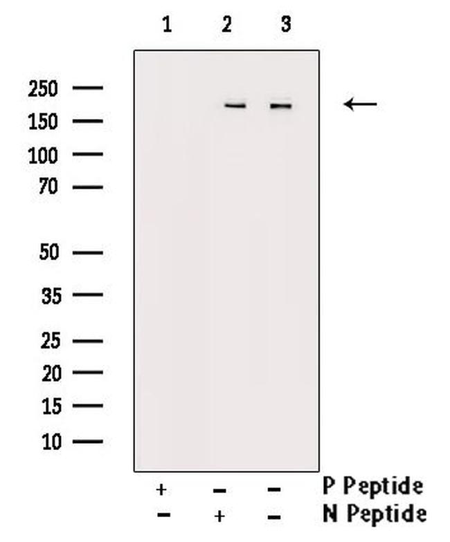 Phospho-FANCD2 (Ser222) Antibody in Western Blot (WB)