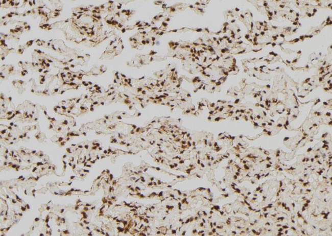 Phospho-GRF-1 (Tyr1105) Antibody in Immunohistochemistry (Paraffin) (IHC (P))