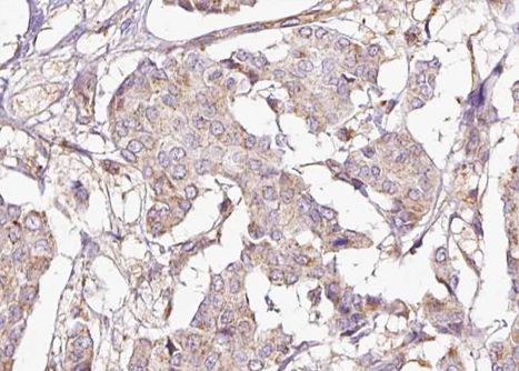 Phospho-DARPP-32 (Thr75) Antibody in Immunohistochemistry (Paraffin) (IHC (P))