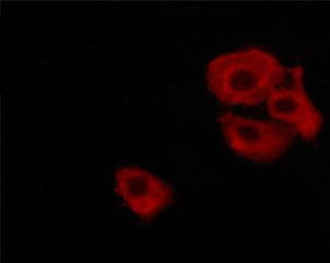 Phospho-DARPP-32 (Thr34) Antibody in Immunocytochemistry (ICC/IF)