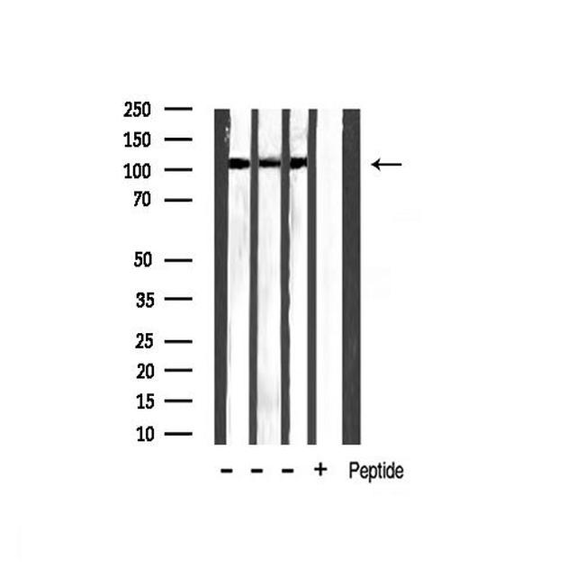 Phospho-HDAC5 (Ser259) Antibody in Western Blot (WB)