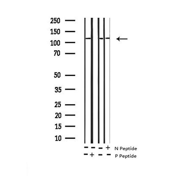 Phospho-HDAC5 (Ser498) Antibody in Western Blot (WB)