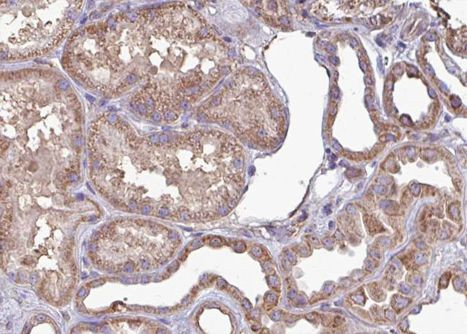 Phospho-CaMKII alpha/delta (Thr286) Antibody in Immunohistochemistry (Paraffin) (IHC (P))