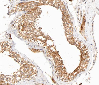 Phospho-IKK gamma (Ser31) Antibody in Immunohistochemistry (Paraffin) (IHC (P))