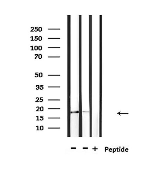 IL-1 beta (Cleaved Asp116) Antibody in Western Blot (WB)