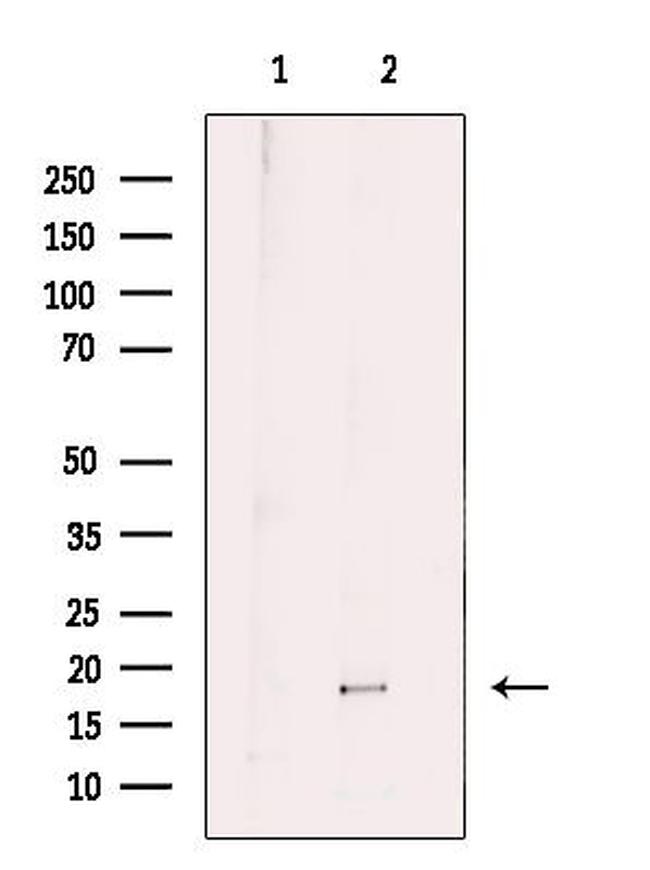 IL-1 beta (Cleaved Asp116) Antibody in Western Blot (WB)