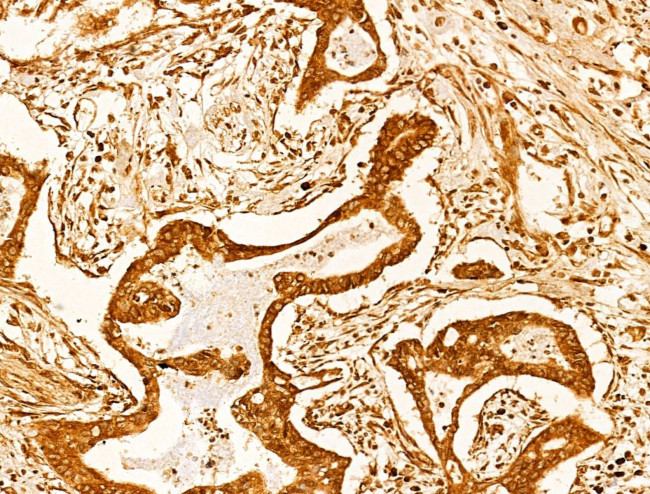 CASPASE 1 P10 (CLEAVED ALA317) Antibody in Immunohistochemistry (Paraffin) (IHC (P))