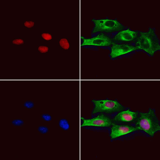 CASPASE 1 P10 (CLEAVED ALA317) Antibody in Immunocytochemistry (ICC/IF)