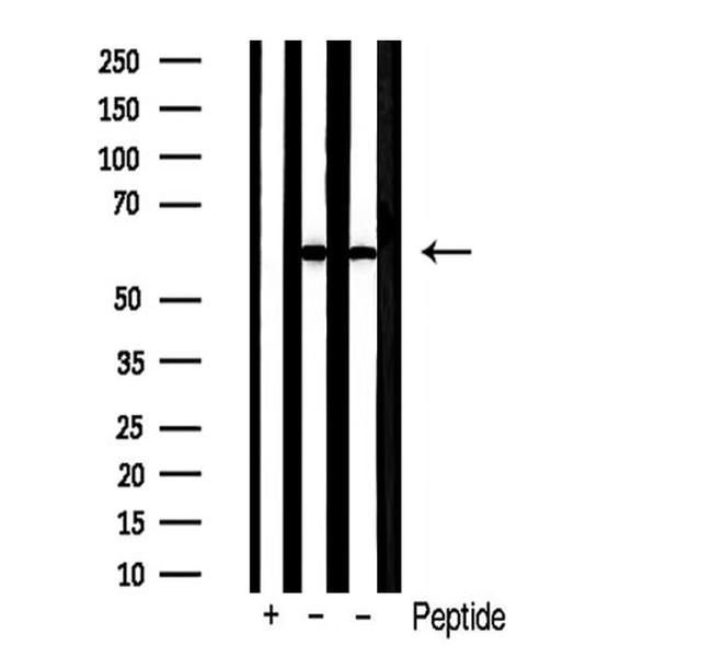 PKM2 Antibody in Western Blot (WB)