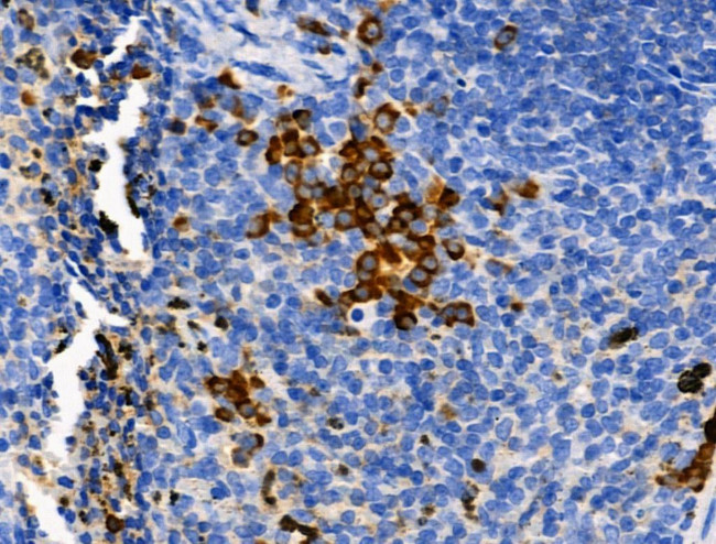 Phospho-PER2 (Ser662) Antibody in Immunohistochemistry (Paraffin) (IHC (P))