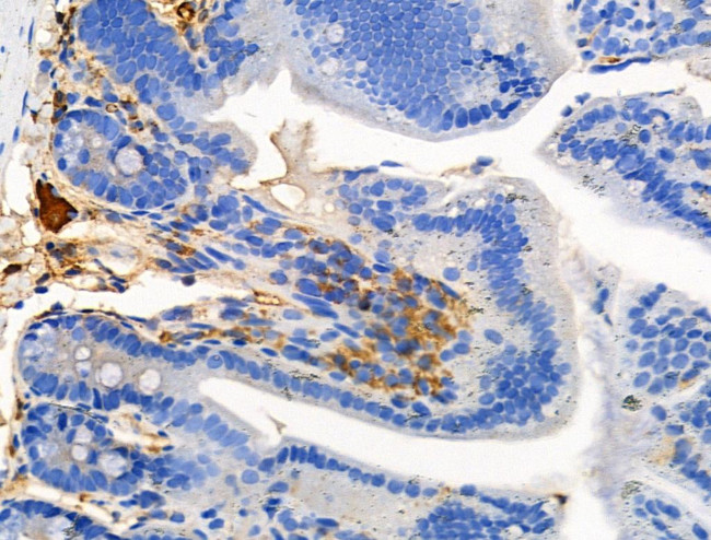 Phospho-ROCK1 (Tyr913) Antibody in Immunohistochemistry (Paraffin) (IHC (P))