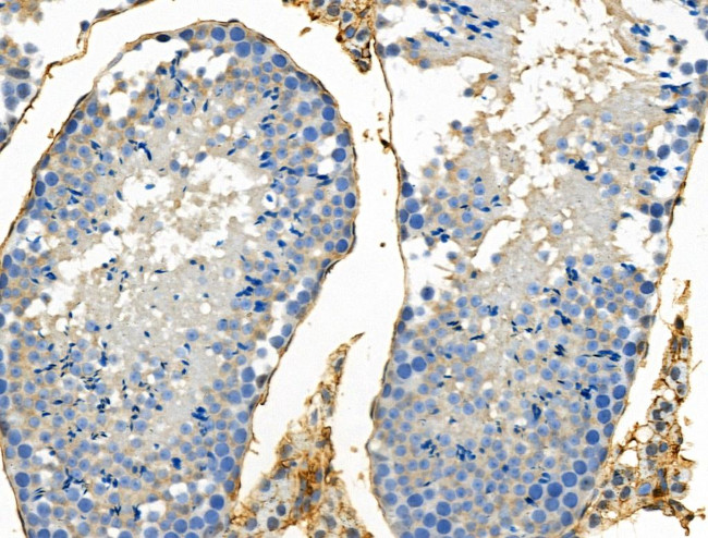 Phospho-Claudin 5 (Thr207 ) Antibody in Immunohistochemistry (Paraffin) (IHC (P))