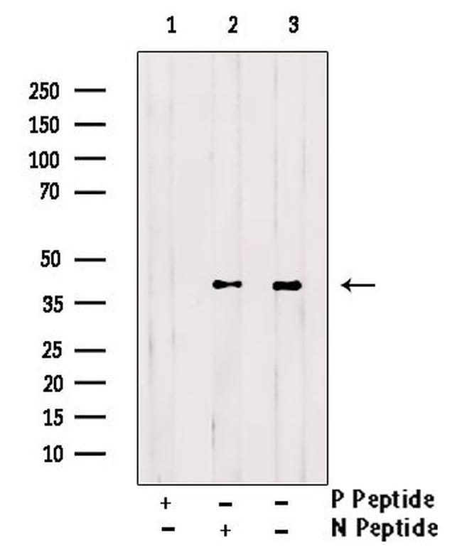 Phospho-CK1 alpha (Thr321) Antibody in Western Blot (WB)