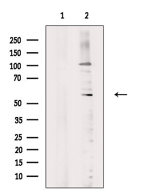 Phospho-PHGDH (Thr78) Antibody in Western Blot (WB)