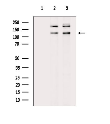 Phospho-53BP2 (Ser698) Antibody in Western Blot (WB)