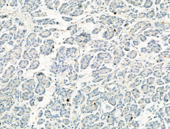 Phospho-NLRP3 (Ser295) Antibody in Immunohistochemistry (Paraffin) (IHC (P))