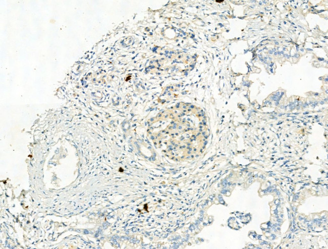 Phospho-NLRP3 (Ser295) Antibody in Immunohistochemistry (Paraffin) (IHC (P))