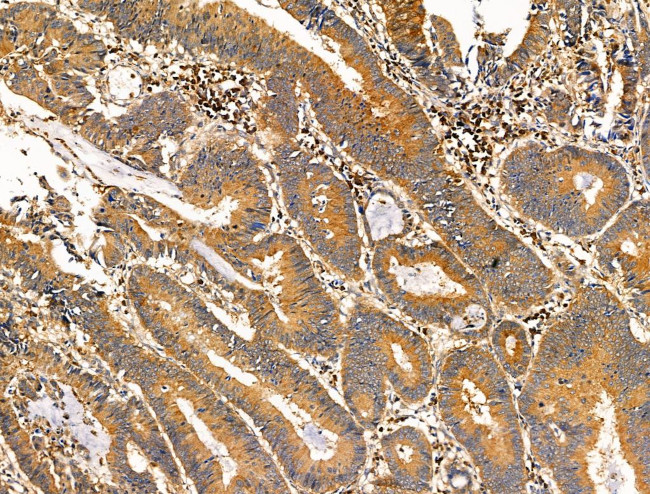 Phospho-NEDD4 (Ser670) Antibody in Immunohistochemistry (Paraffin) (IHC (P))