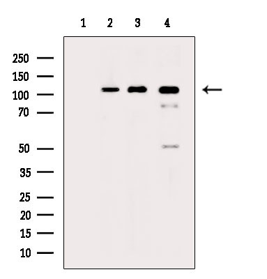 Phospho-NEDD4 (Ser670) Antibody in Western Blot (WB)