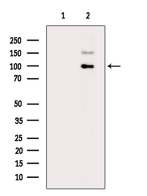 Phospho-CYLD (Ser422) Antibody in Western Blot (WB)