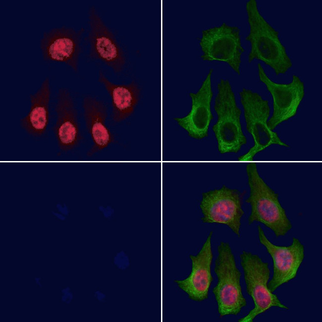 Phospho-BRG1 (Ser610) Antibody in Immunocytochemistry (ICC/IF)