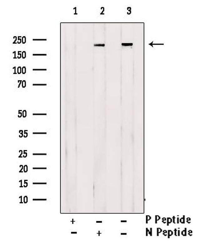 Phospho-BRG1 (Ser610) Antibody in Western Blot (WB)