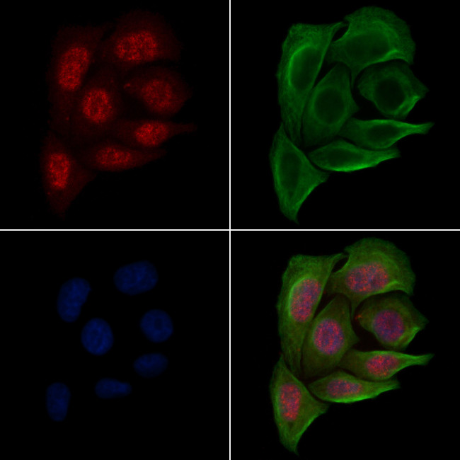 Phospho-PABPN1 (Ser150) Antibody in Immunocytochemistry (ICC/IF)