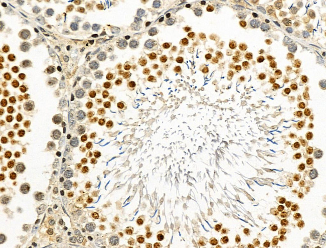 Phospho-PABPN1 (Ser150) Antibody in Immunohistochemistry (Paraffin) (IHC (P))