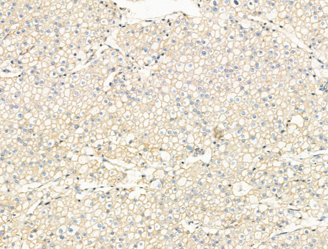 Phospho-KSR2 (Thr497) Antibody in Immunohistochemistry (Paraffin) (IHC (P))