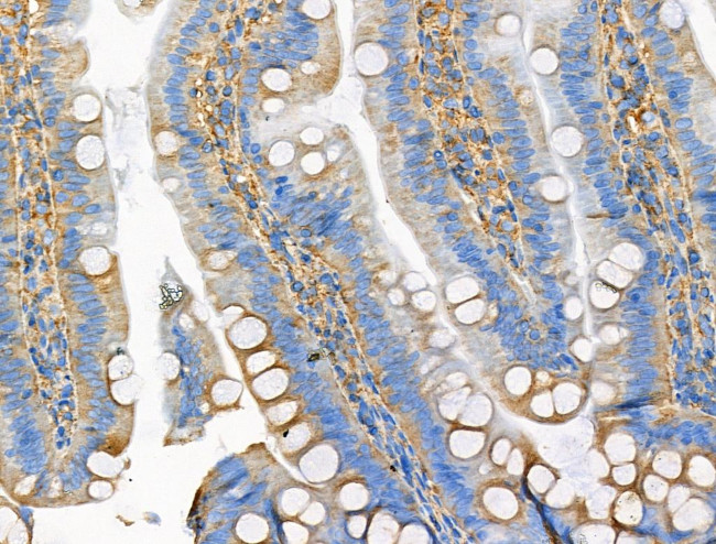 Phospho-KSR2 (Thr497) Antibody in Immunohistochemistry (Paraffin) (IHC (P))