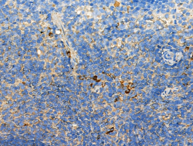 Phospho-KSR2 (Thr497) Antibody in Immunohistochemistry (Paraffin) (IHC (P))