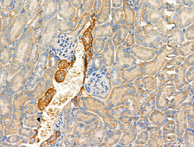 Phospho-KSR2 (Thr497) Antibody in Immunohistochemistry (Paraffin) (IHC (P))