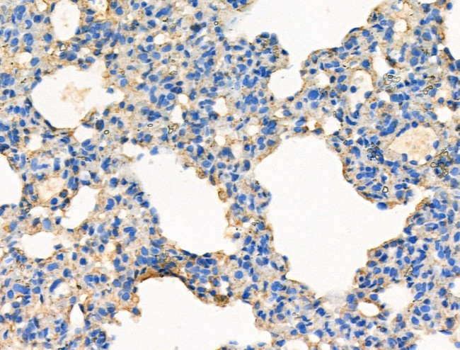 Phospho-KSR2 (Thr497) Antibody in Immunohistochemistry (Paraffin) (IHC (P))