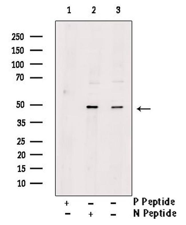 Phospho-PAR1 (Tyr420) Antibody in Western Blot (WB)