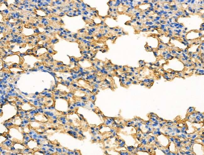 Phospho-LRP5 (Tyr1473) Antibody in Immunohistochemistry (Paraffin) (IHC (P))