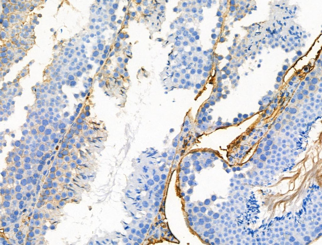 Phospho-LRP5 (Tyr1473) Antibody in Immunohistochemistry (Paraffin) (IHC (P))