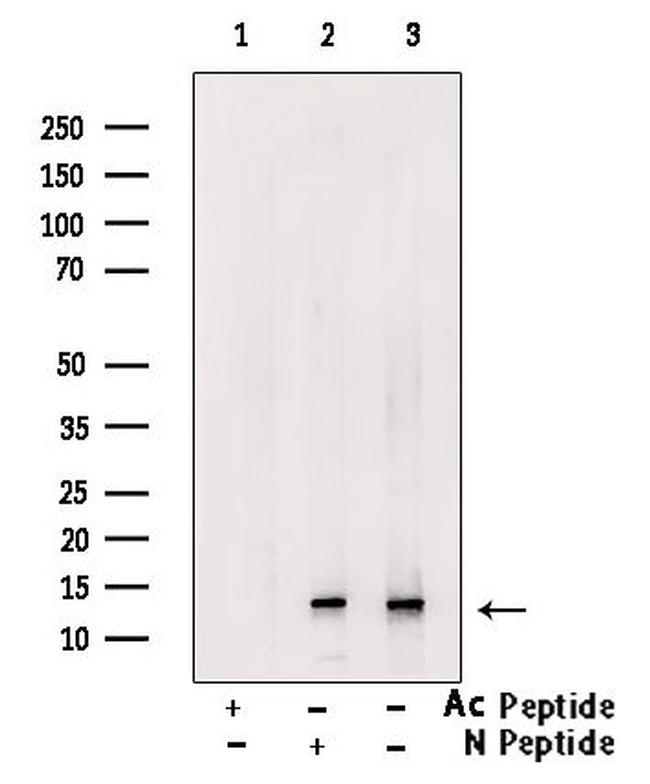 H2BK16ac Antibody in Western Blot (WB)