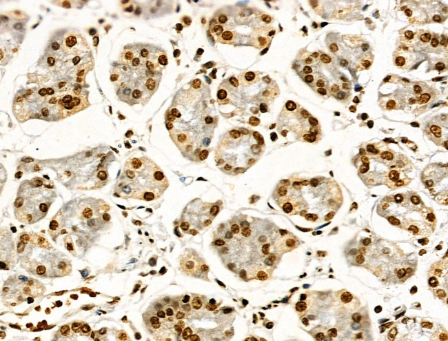 H2BK16ac Antibody in Immunohistochemistry (Paraffin) (IHC (P))