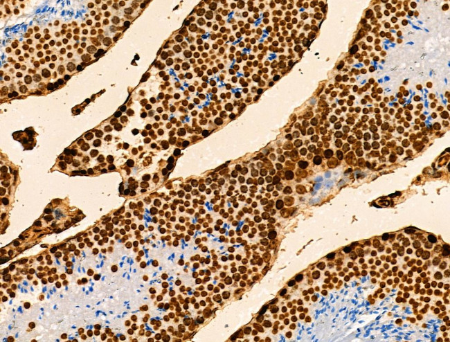 H2BK16ac Antibody in Immunohistochemistry (Paraffin) (IHC (P))