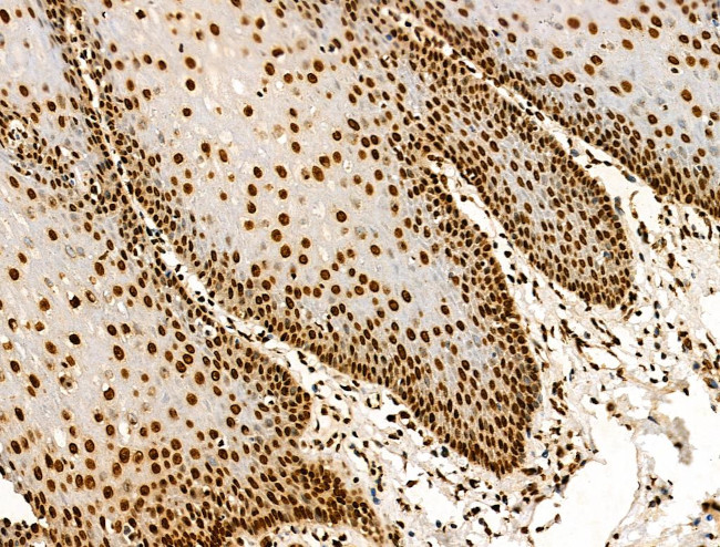 H2BK16ac Antibody in Immunohistochemistry (Paraffin) (IHC (P))