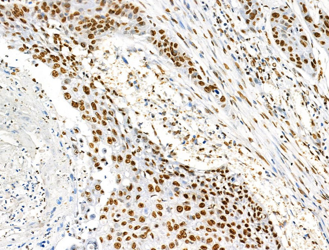 H2BK16ac Antibody in Immunohistochemistry (Paraffin) (IHC (P))