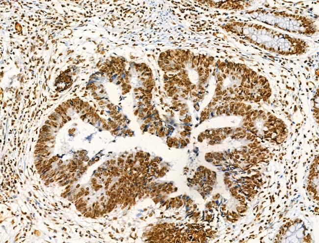 H2BK16ac Antibody in Immunohistochemistry (Paraffin) (IHC (P))